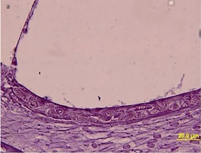 Assessment of the Effectiveness of Quercetin on Cisplatin-Induced Ototoxicity in Rats