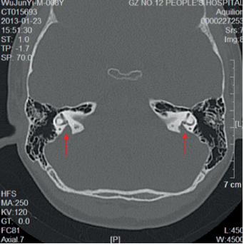 Variations in the Mutational Spectrum in Nonsyndromic Hearing Impairment: A study of the Special Schools for the Deaf in Southern China