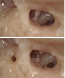 A New Application of CBCT Image Fusion in Temporal Bone Studies